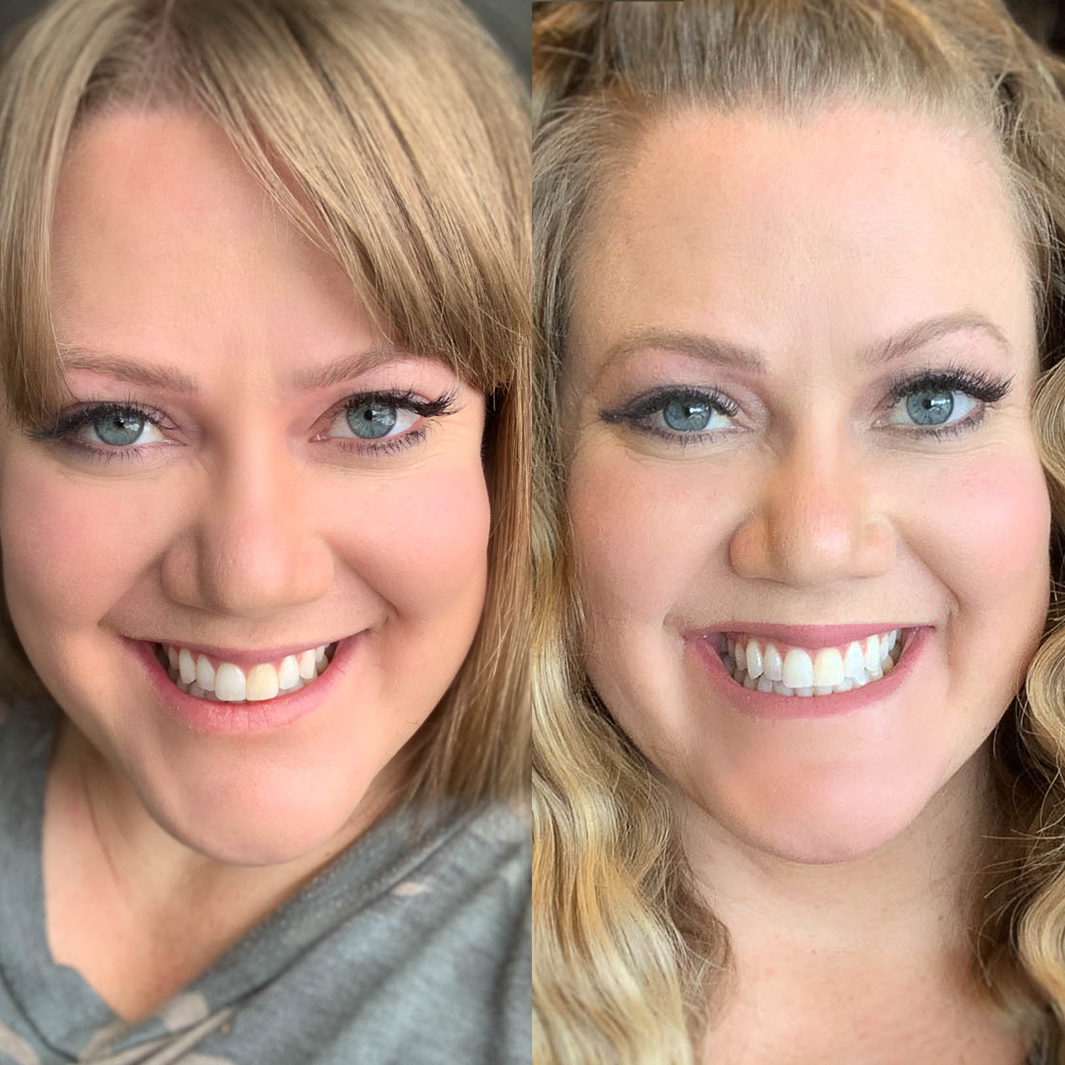 I tried the crest 3D whitestrips for 14 days *effective* 2023